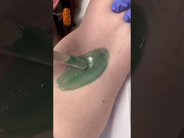Professional waxing of short under arm hair using hard wax from nacach #esthetician #waxing | Filipina spa at home